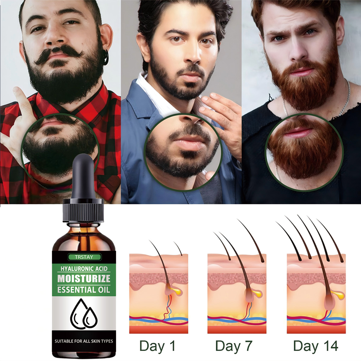 100% طبيعي تسريع شعر الوجه تنم - مراجعة Men'S Grooming Products وسعره